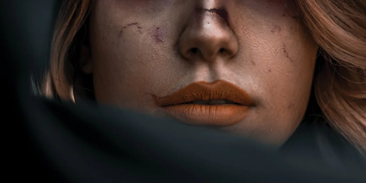 Close-up of a woman's face with scars on the cheeks and nose, showcasing a somber expression.