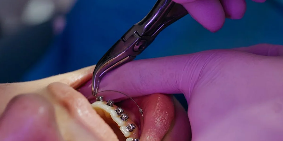 Close-up of a dentist's gloved hands performing a dental procedure inside a patient's open mouth.